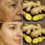 Ghimbirul și Mitul „Botoxului Natural de 100 de Ori Mai Puternic” – Ce Este Adevărat, Ce Este Exagerare și Cum Îți Îngrijești Corect Pielea Image 15