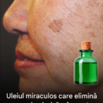 „Uleiul Miraculos” pentru Petele de Vârstă – Realitate, Mit și Cum Să Ai Grijă Corect de Piele Image 26