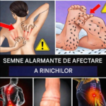 15 semne de alarmă ale bolilor renale pe care nu trebuie să le ignori Image 32