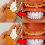 Cum să îți îmbunătățești aspectul dinților acasă pentru un zâmbet mai strălucitor și natural Image 55