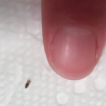 Soția a găsit asta în părul copilului nostru. Ar trebui să ne îngrijorăm? Ghid complet pentru părinții copiilor care merg la grădiniță Image 53