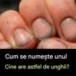Unghiile murdare: Între igienă și muncă asiduă cf-featured-106
