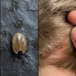 Ghid complet pentru identificarea și gestionarea insectelor pe scalpul copiilor cf-featured-377