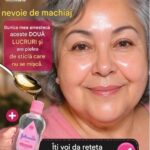 Cum să reduci petele închise la culoare de pe piele: remedii naturale eficiente cf-featured-606